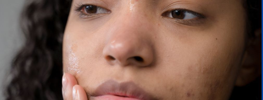 Grafika dla artykułu Organiczne kosmetyki do pielęgnacji skóry z problemami